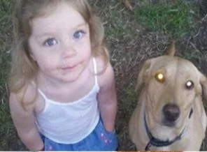 Bu kızın yaşaması bir köpeğe bağlı