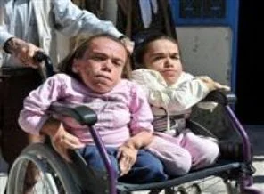 Doktorlar ''en fazla 3 yıl yaşar'' dedi ama...