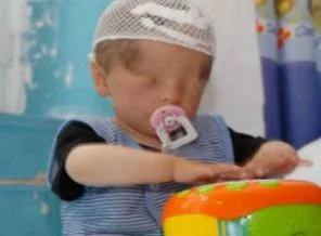 Gözleri doğuştan yok ama...