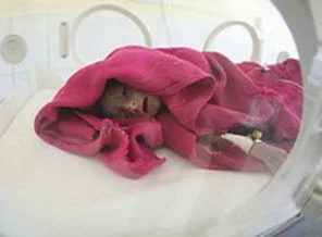 Prematüre doğumda ruhsal sorun riski