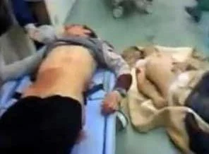 Suriye'de sokaklar cesetten geçilmiyor