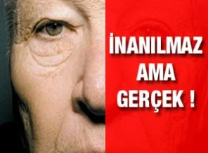 Yüzünün bir yanı 40, diğer yanı...