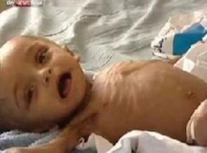 250 bin çocuk ölüm tehlikesi altında