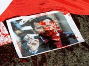 72 yaşındaki imamın gözlerini oydular