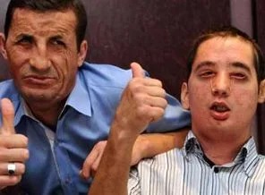 Birinci ile dördüncü bir arada