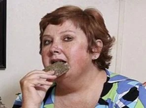 Haftada iki kilo taş yiyor