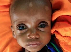 Somalili aileye cami cemaati sahip çıktı