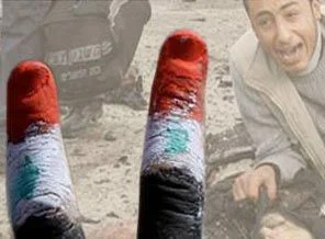 "Vur!" emrini reddetti, yakılarak katledildi!