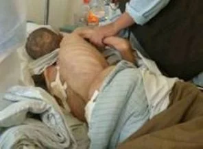 İngiliz askerlerinin cesetlerinden parçaları izinsiz saklanmış