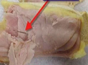 Uçakta verilen sandviçten dikiş iğnesi çıktı