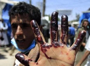 Yemen'de silahlı saldırı: 1 ölü