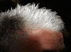 Beyaz saç hastalık habercisi olabilir