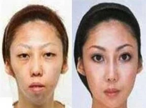 Estetikle kandırdığı eşine tazminat ödeyecek