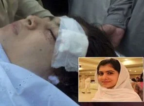 Taliban'ın başından vurduğu çocuk dönüyor