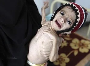 Yemen'de açlık krizi!