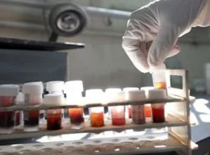 AIDS orta yaşlıları ve erkekleri vuruyor