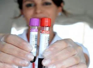 Kan yerine tükürükten test başladı