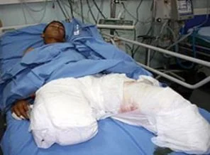 'Saldırılar 60 Filistinli'yi özürlü hale getirdi'