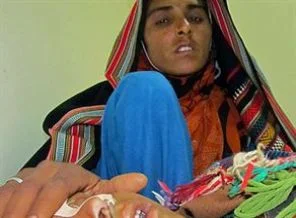 Pakistan'da kızamıktan ölenlerin sayısı 143 oldu