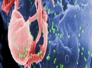 Dikkatsiz diş hekimi yüzünden 7 bin kişi HIV riski taşıyor