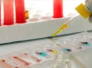 HIV'le mücadelede başarı