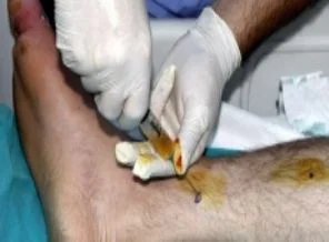 İstenmeyen yağlar 'aşı'ya dönüştürüldü