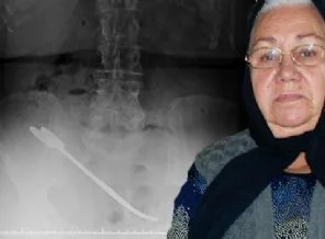 'Karnınızda makas unuttuk, pardon!'