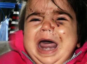 11 aylık bebeğin kafasını fare ısırdı