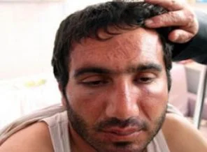Bismil'deki işkence iddiasına jet soruşturma