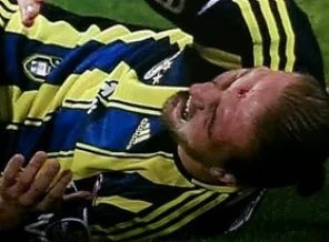Caner'in alnı yarıldı
