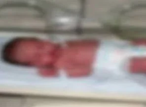 Çöp atmaya gitti poşette bebek buldu