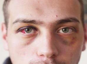 Karar: Asker kendi kendini dövmüş