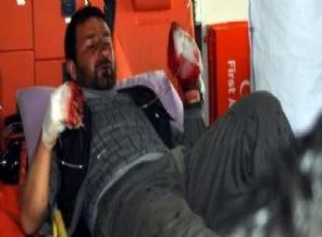 Mayın çobanın elinde patladı