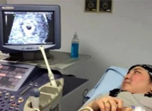 ''Mucize'' bebeğin kalp atışları duyuldu