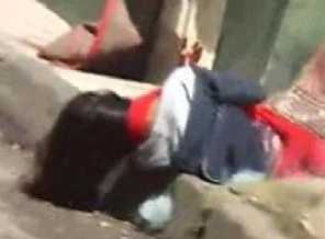 Gaz bombası kafatasını kırdı, hayatı tehlikede