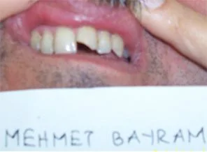 İşkence kararı için savcı tanık olacak