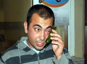 Önce yumruk attı, sonra bakın ne yaptı...