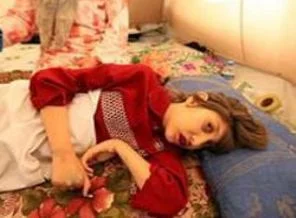 Tegme yaşam savaşını kaybetti