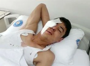 Antalya'da bir eylemci gözünü kaybetti