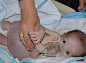 Çaresiz bebek yardım bekliyor