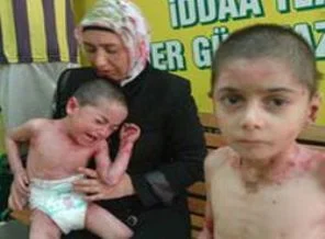 'Çocuklarım gözlerimin önünde eriyor'