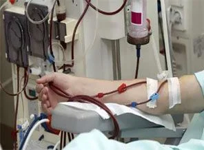Diyaliz hastalarına tatil müjdesi