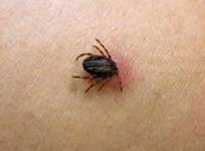Erzurum'da kene can aldı