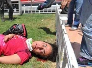 Gezi'de yaralanan Lobna 12 gündür gözlerini açamadı