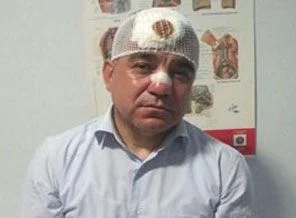 Gezi eyleminde burnu kırılan vekil konuştu