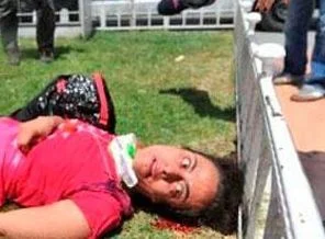 Gezi Parkı protestolarında yaralanan Lavna Allani'nin durumu kritik