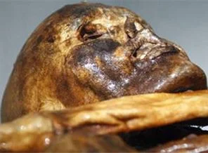 'Ötzi başına aldığı darbeyle ölmüş olabilir'