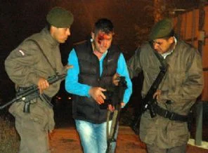 Polisin gazı Yarbay'ı vurdu: Gözünü kaybedebilir