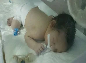 5 günlük bebek yaşam mücadelesi veriyor