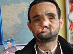 5'inci yüz naklinde deniz suyu polemiği!